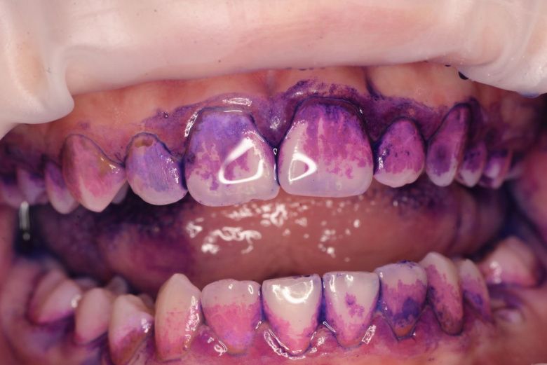  - photo before the procedure