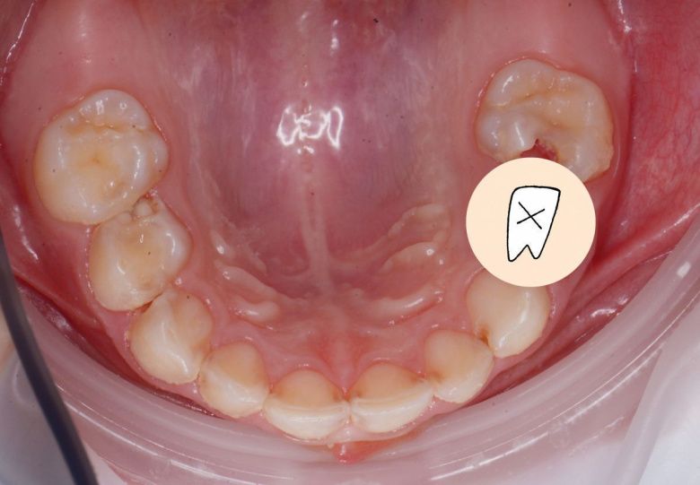  - photo before the procedure