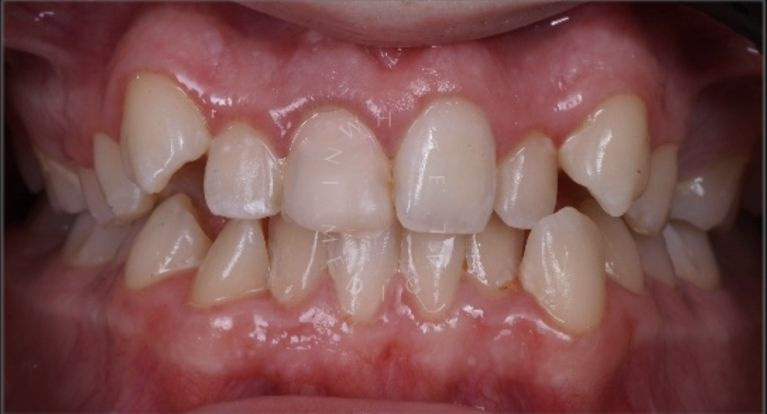  - photo before the procedure