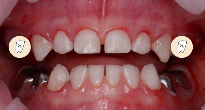  - photo after the procedure