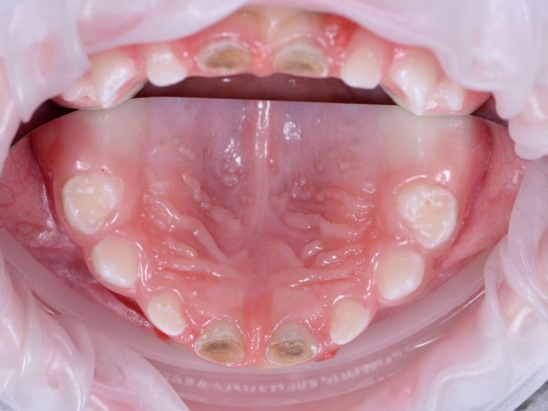  - photo before the procedure