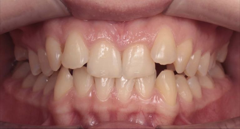  - photo before the procedure