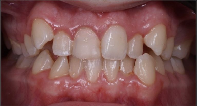  - photo before the procedure