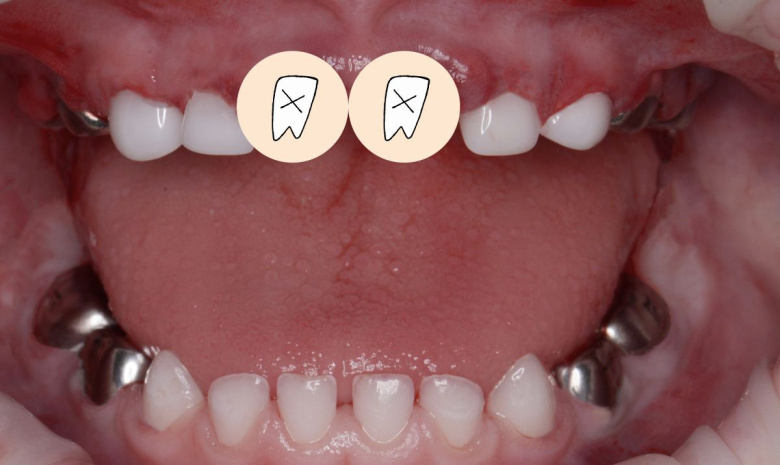  - photo after the procedure