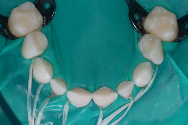  - photo after the procedure