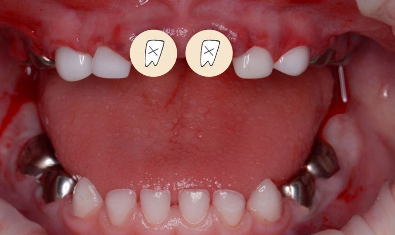  - photo after the procedure