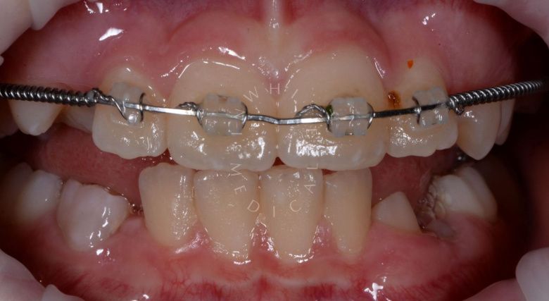  - photo before the procedure
