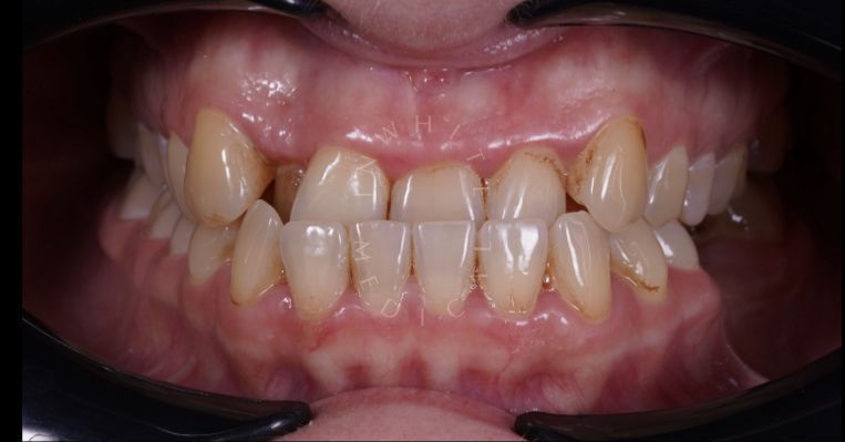  - photo before the procedure