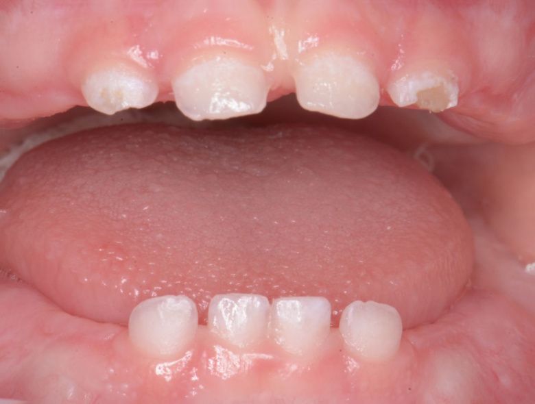 - photo before the procedure