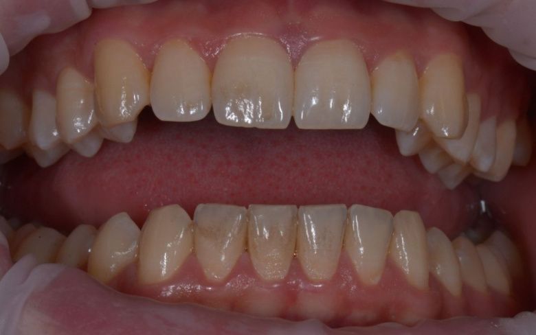  - photo before the procedure