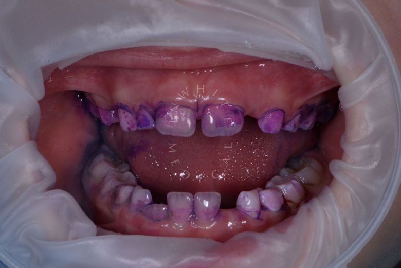  - photo before the procedure