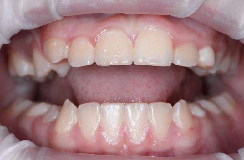  - photo before the procedure