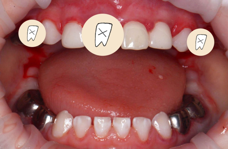  - photo after the procedure