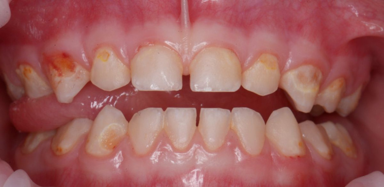  - photo before the procedure