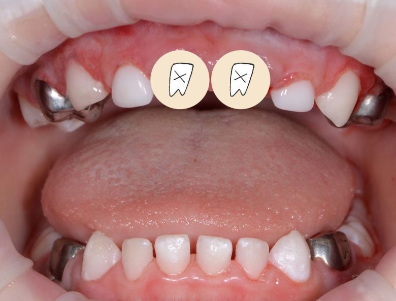  - photo after the procedure