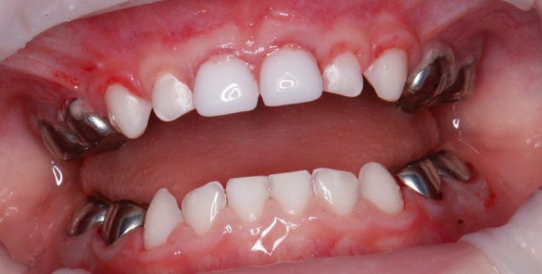  - photo after the procedure