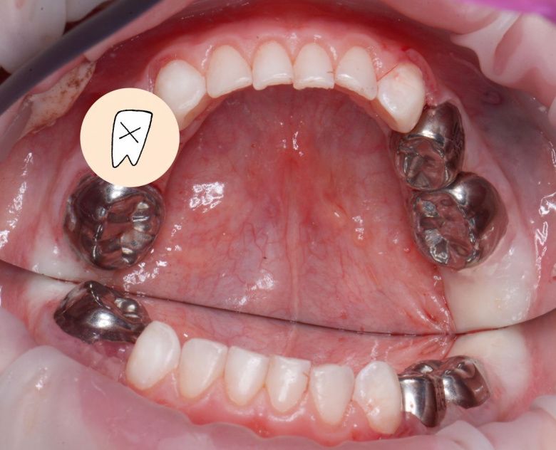  - photo after the procedure