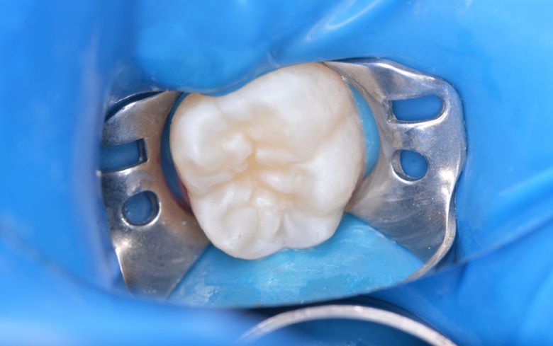  - photo before the procedure