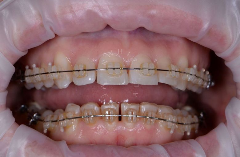  - photo before the procedure