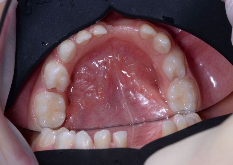  - photo before the procedure