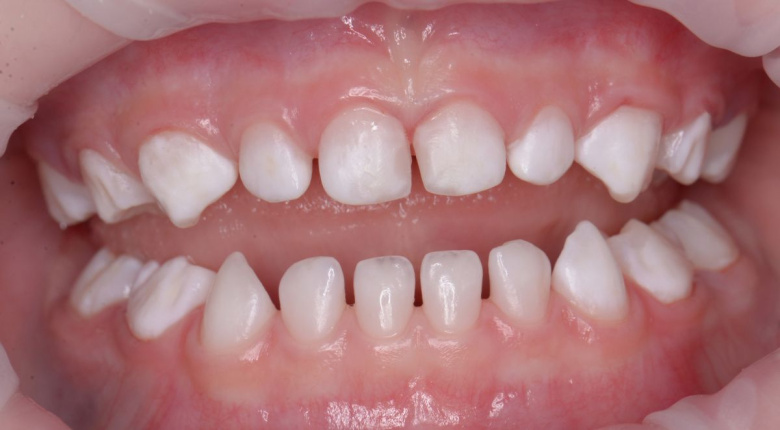  - photo after the procedure