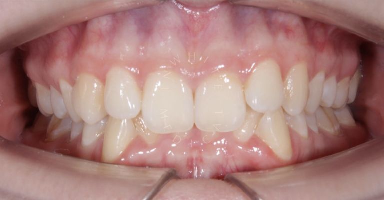  - photo before the procedure