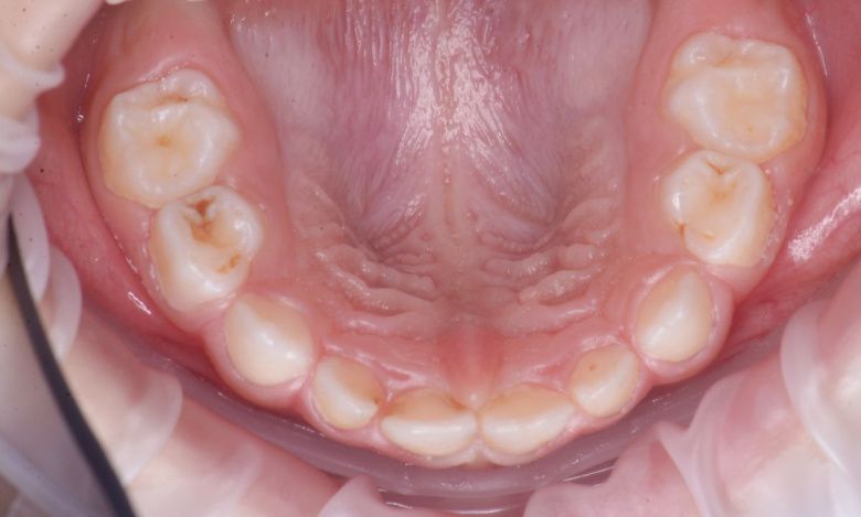  - photo before the procedure